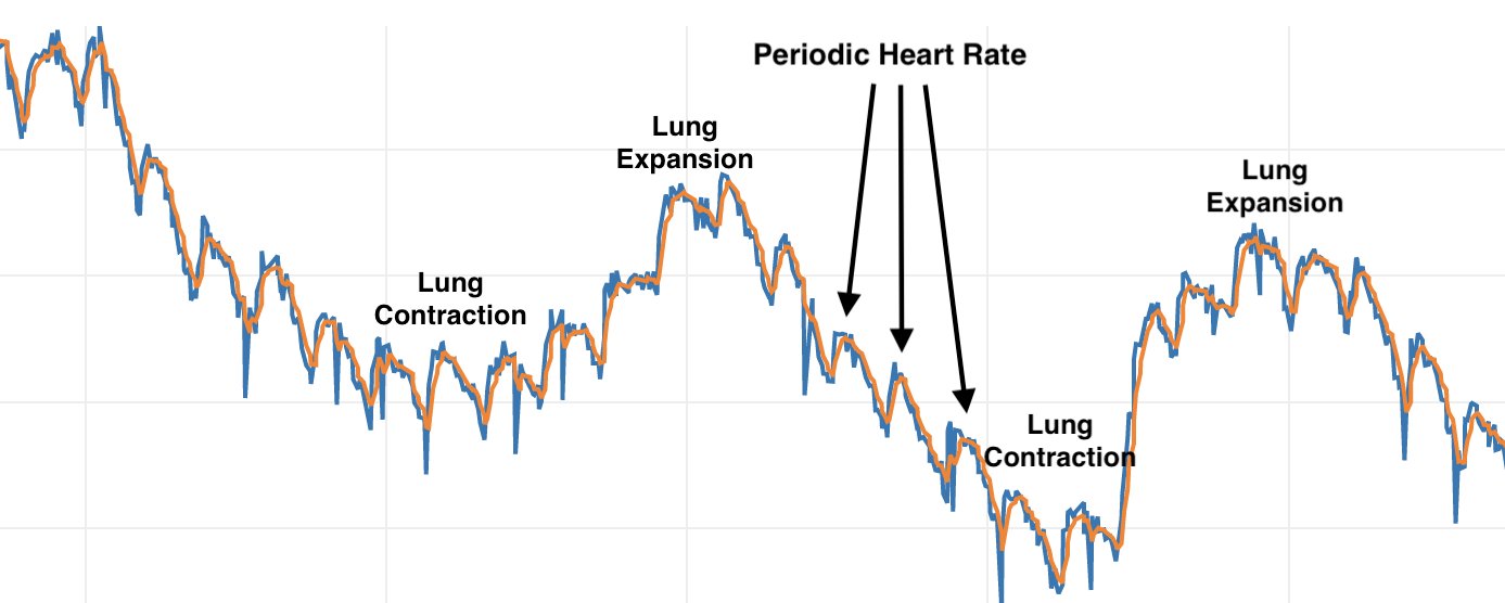 Time series changes