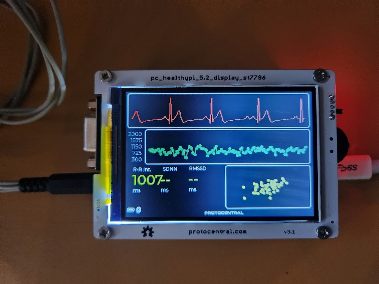 HealthyPi 5 HRV