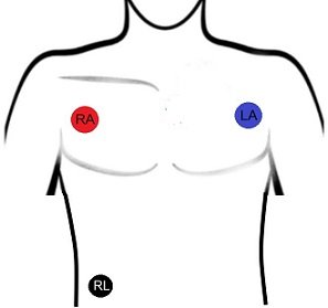 Electrode placement for respiration measurement