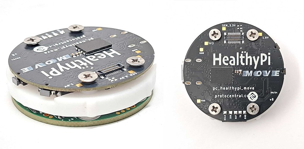 HealthyPi Move Internal Chassis