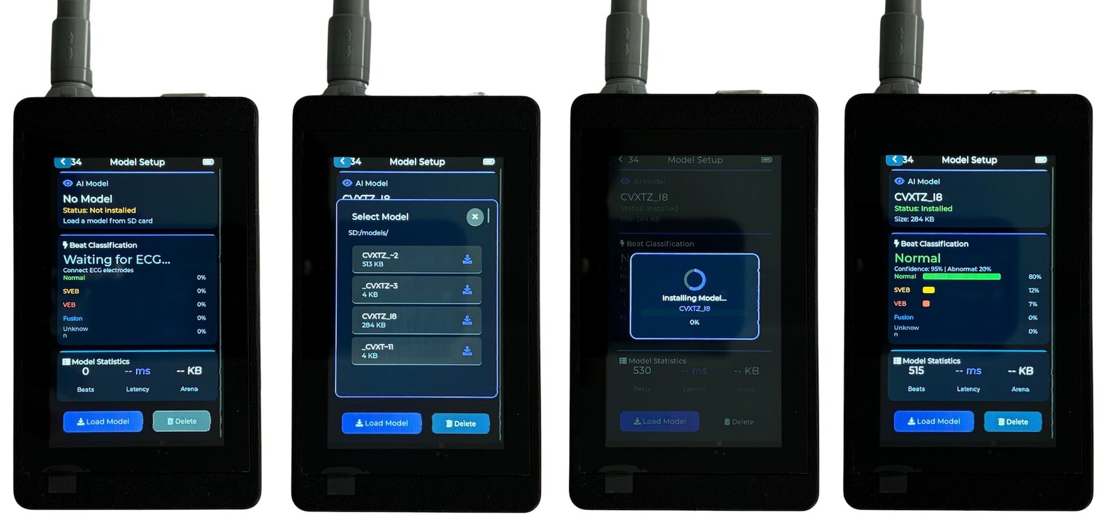 Model Setup Screen