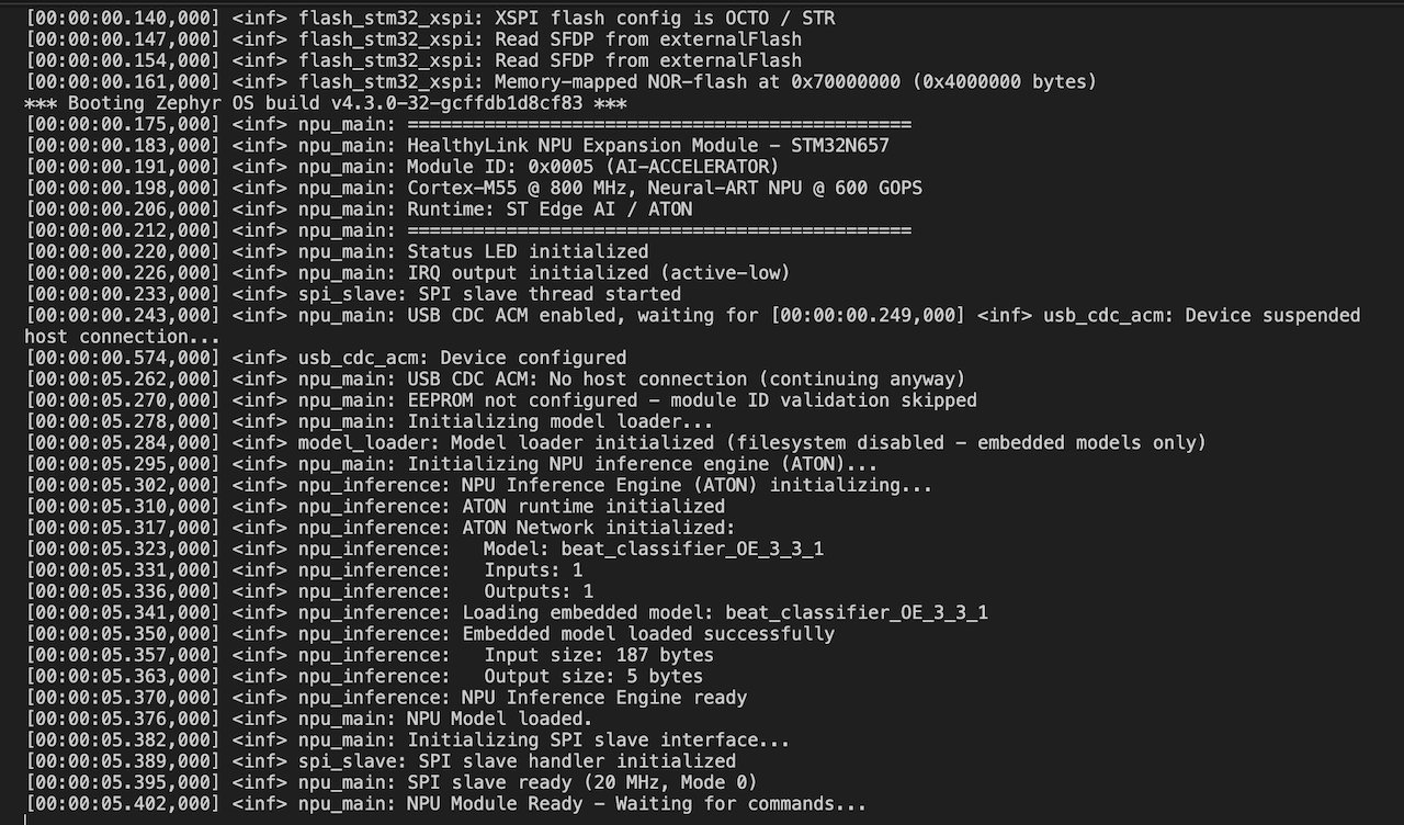 Current firmware boot log: The Edge AI Accelerator initializes the Cortex-M55, loads the beat classifier model, and waits for SPI commands from HealthyPi 6.