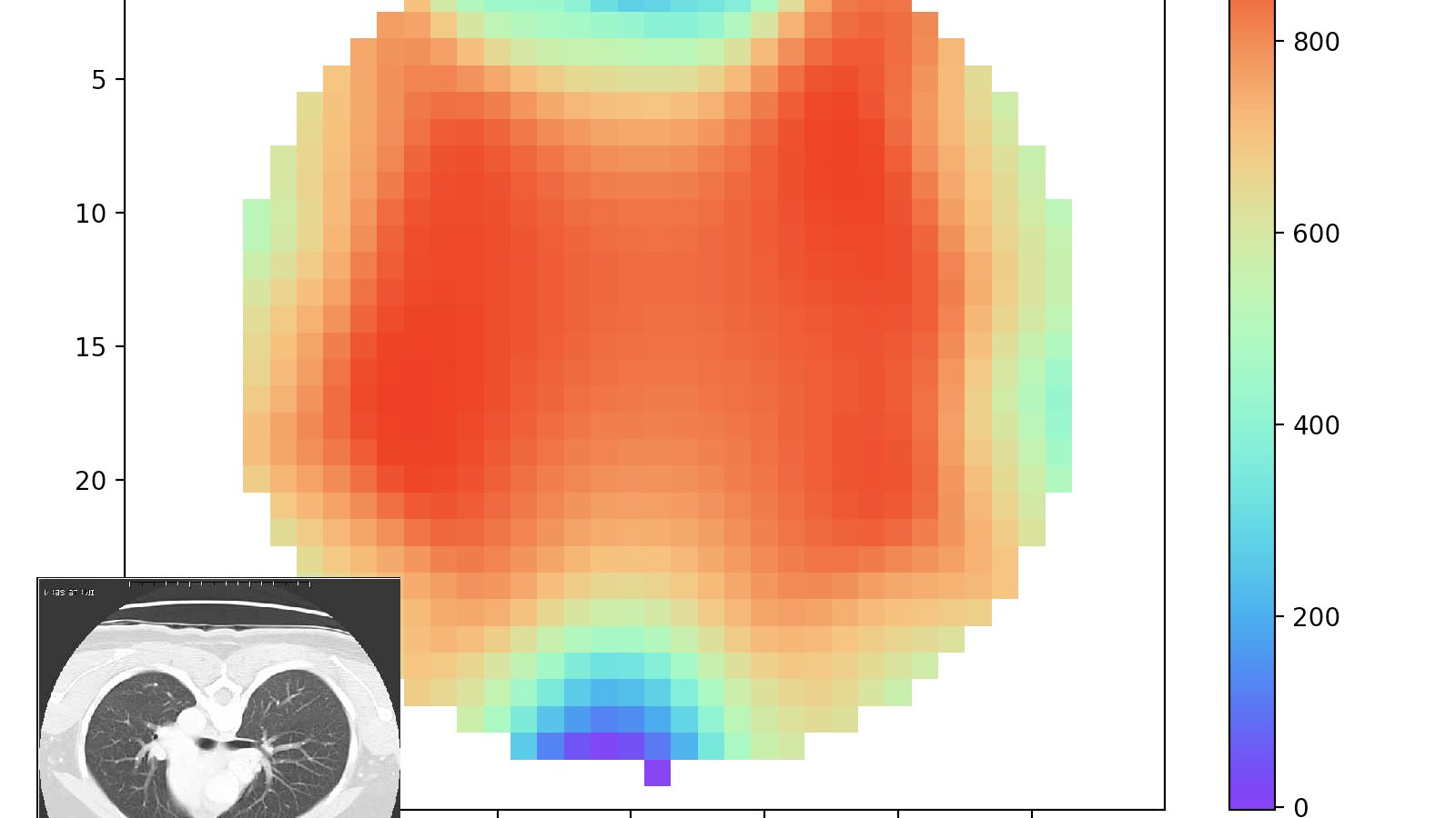 Lung cross-section at a single 50 kHz frequency