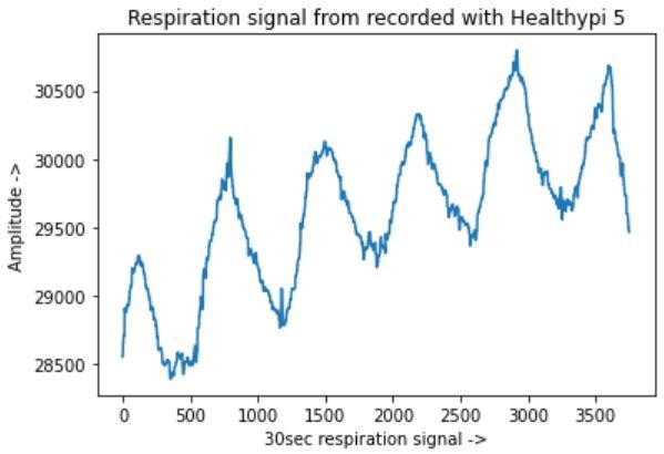 Respiration waveform
