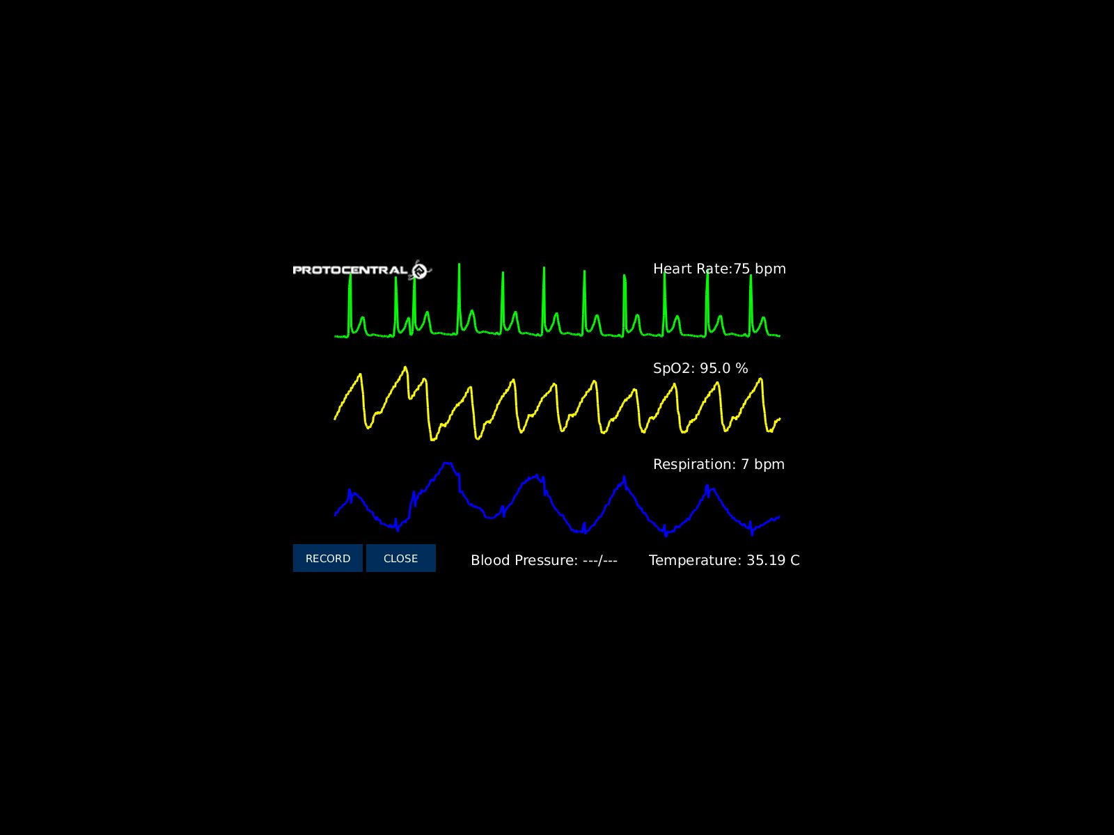HealthyPi