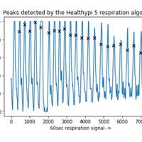 Filtered respiration waveform