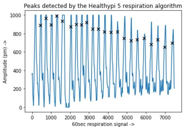 Filtered respiration waveform