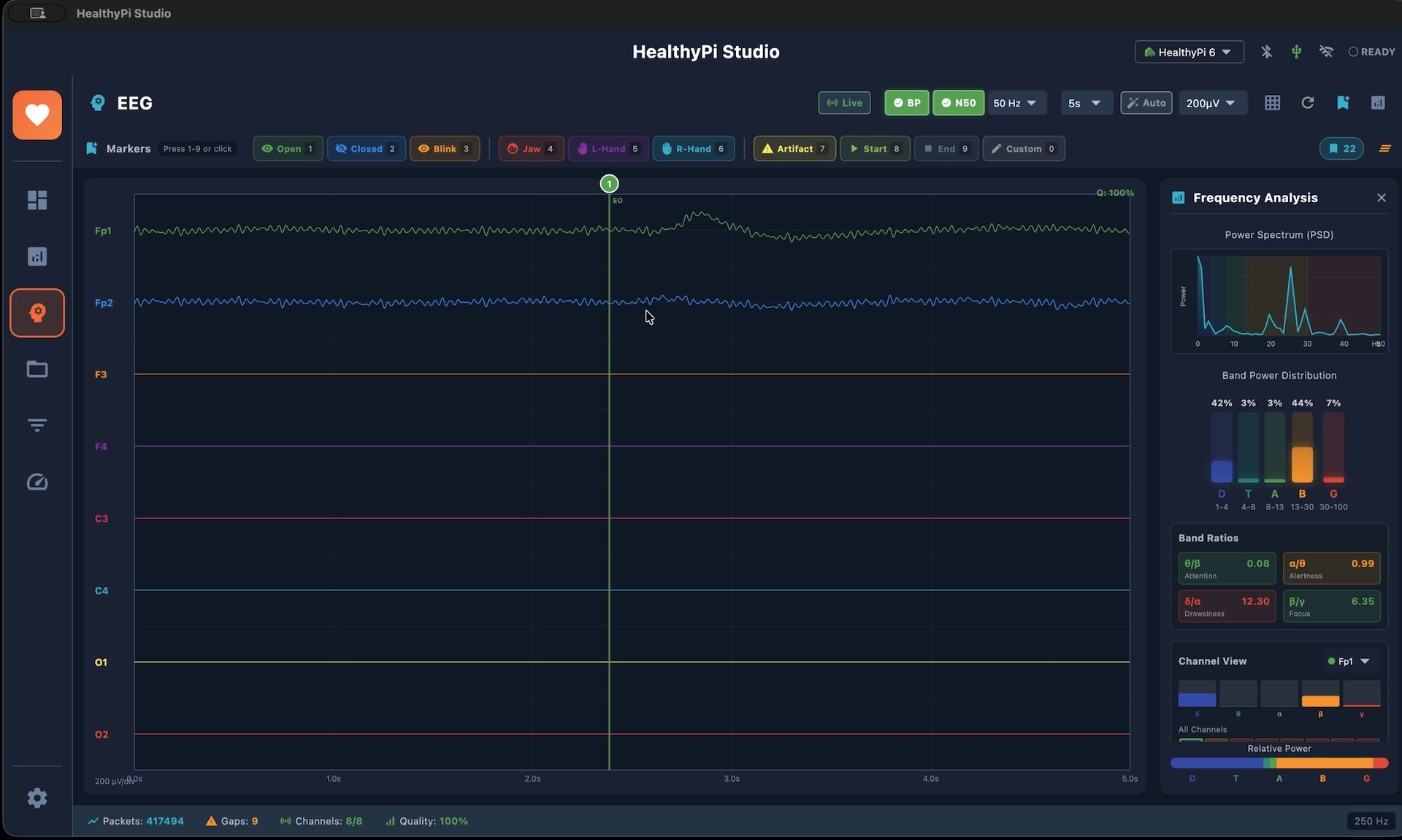 HealthyPi 6 - EEG in Action | Crowd Supply